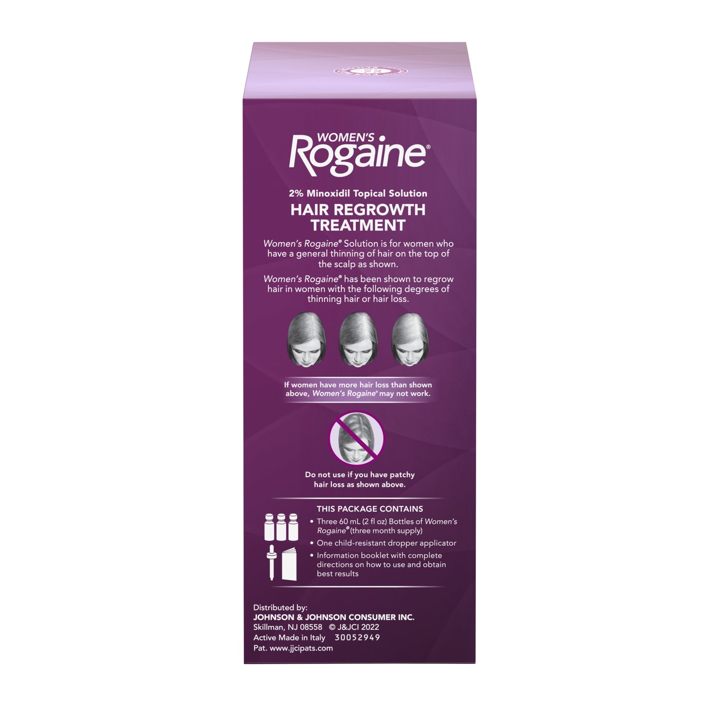 The side of a box of Women's Rogaine Topical Solution, showing the types of hair loss Rogaine works best for
